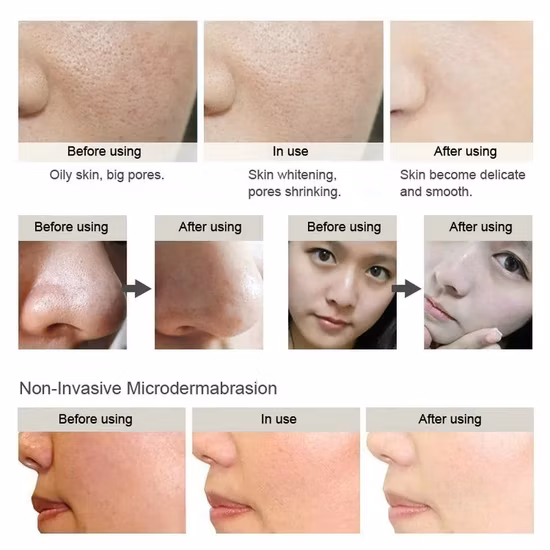 Best Exfoliator for Body Natural SPA and Skin Care Product for Women